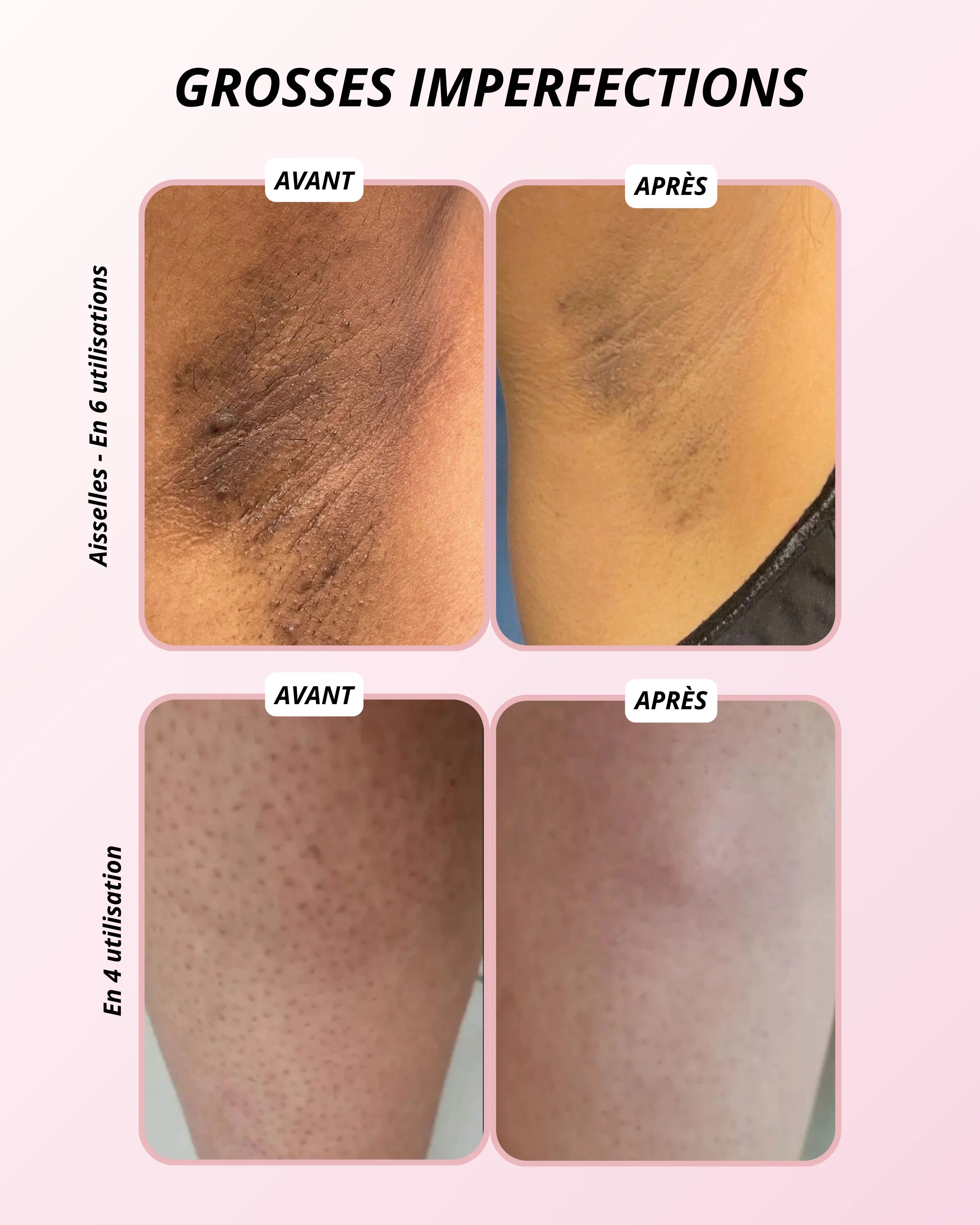 Gant Exfoliant en Soie - Corps